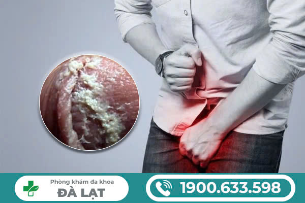 Hình ảnh minh họa